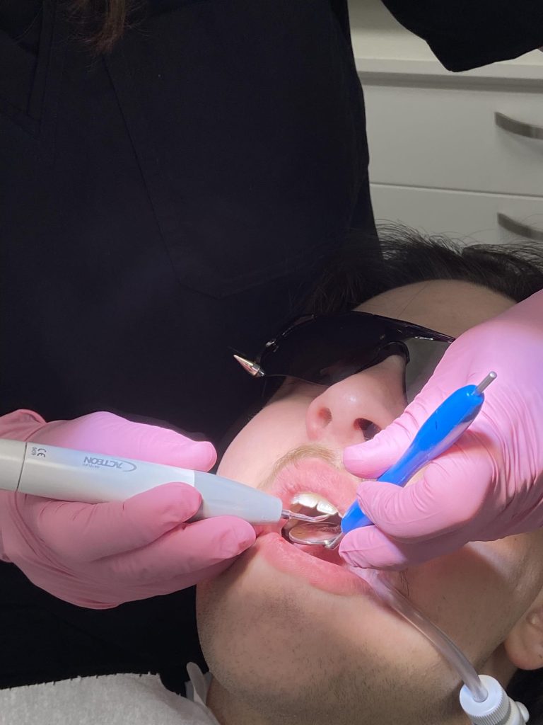 Hammaskiven poisto, hammaslääkäri, nainen